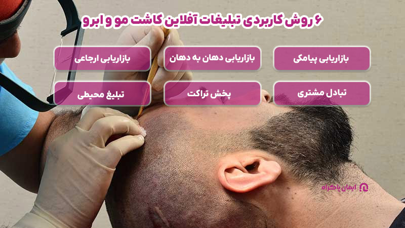 6 روش‌ کاربردی تبلیغات آفلاین کاشت مو و ابرو